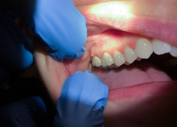 Best Emergency Dentist for Knocked-Out Tooth in Cotulla, TX